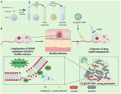 Synergistic antibacterial effects of ultrasound combined nanoparticles encapsulated with cellulase and levofloxacin on Bacillus Calmette-Guérin biofilms